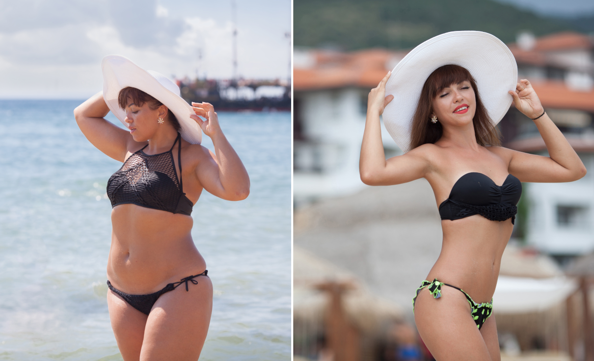 Obesity. Colonic irrigation in Newham and Colchester