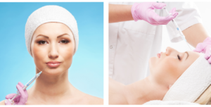 Platelet-rich-plasma injections