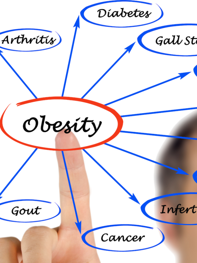 Anti-obesity program