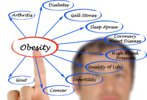 Are overweight and infertility related? Fat burners, or a panacea for losing weight?