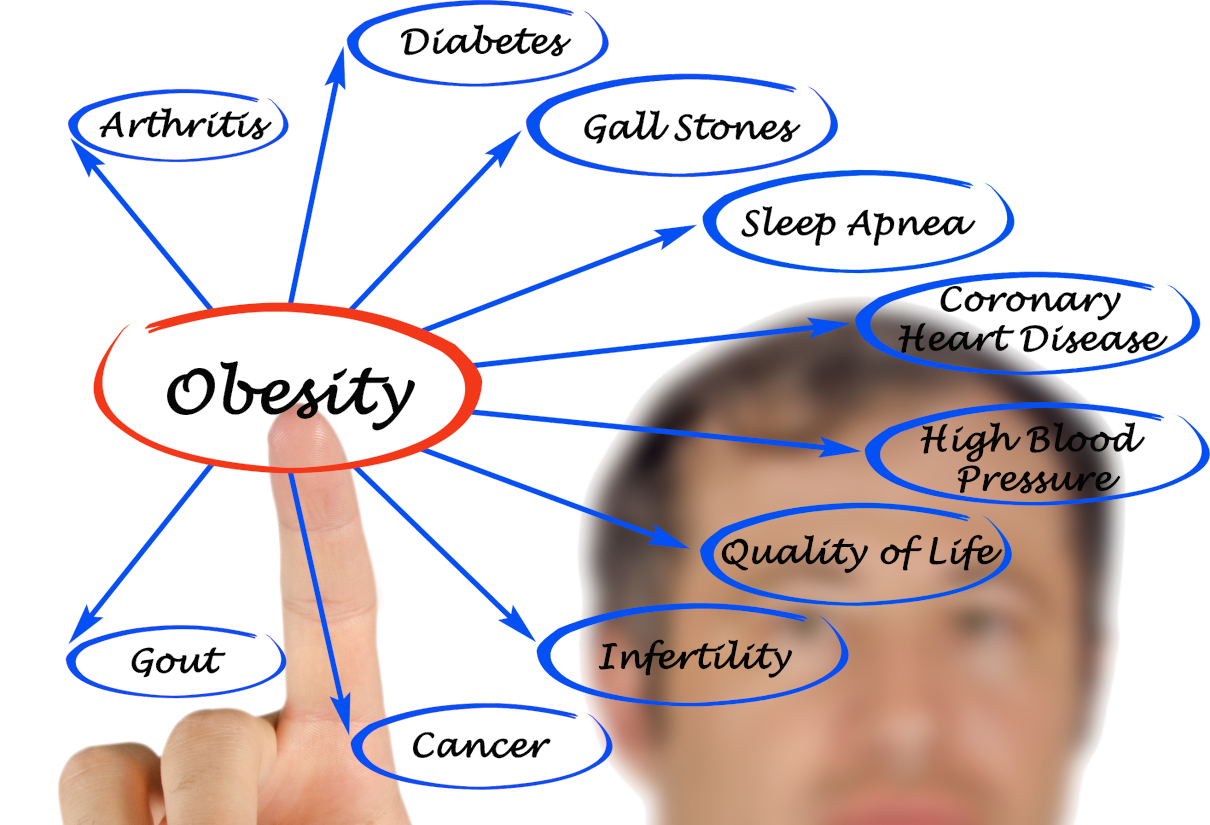 Are overweight and infertility related? Fat burners, or a panacea for losing weight?