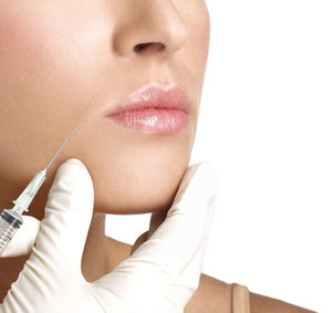 Dermal Fillers - Smile Marionette lines