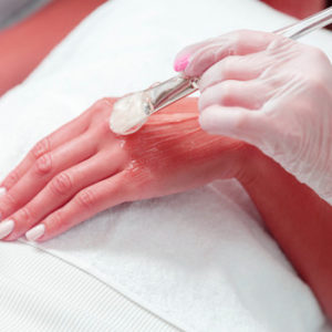 One Diamond Microdermabrasion session for hands