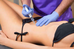 Mesotherapy for cellulite and fat reduction - lipolysis