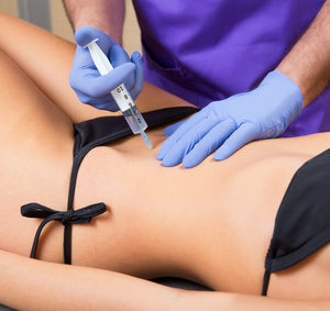 Mesotherapy for cellulite and fat reduction - lipolysis
