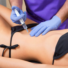 Mesotherapy for cellulite and fat reduction - lipolysis in Chiswick