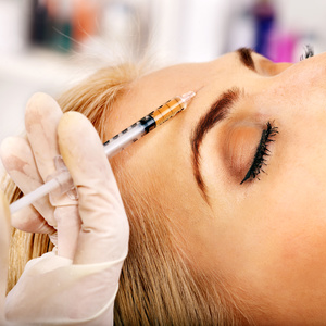 Eight Points facelift with Dermal Fillers and Wrinkles relaxing