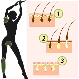 Full leg + Hollywood or Brazilian + underarm + full arm waxing at Parkland Natural Health