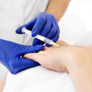 Hands rejuvenation with Dermal Fillers