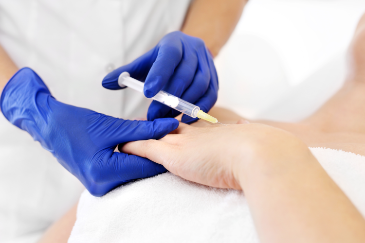 Hands rejuvenation with Dermal Fillers
