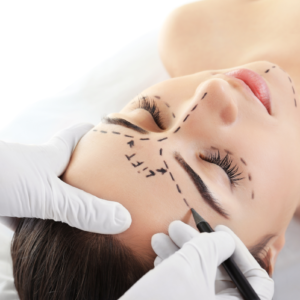 PDO Beauty Threads Lift - Forehead Lines