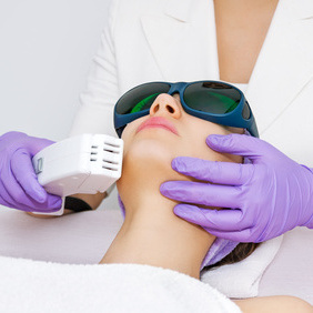 Chin+Jawline+Sideburns laser hair removal