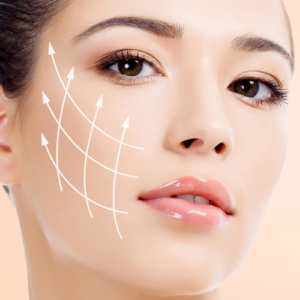 The lower facelift with PDO Beauty Threads