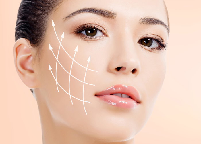 The lower facelift with PDO Beauty Threads