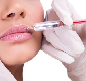 Lip correction or augmentation with dermal fillers