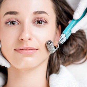 Three sessions of Micro-Needling for Face, Neck and Decollete - three sessions with Dermal Roller SR