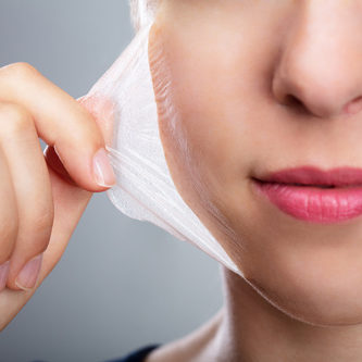 What is BCN Peeling for acne/problematic skin?