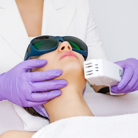 Single treatment of full face IPL permanent hair reduction