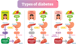 Blood sugar balance and glycaemic level