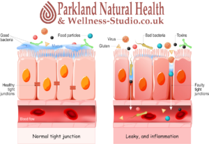 Leaky Gut Syndrome