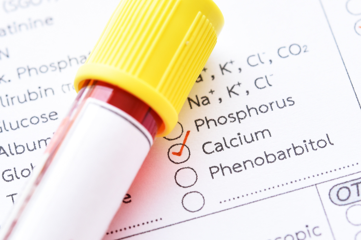 SERUM CALCIUM and medicinal hypocalcemia