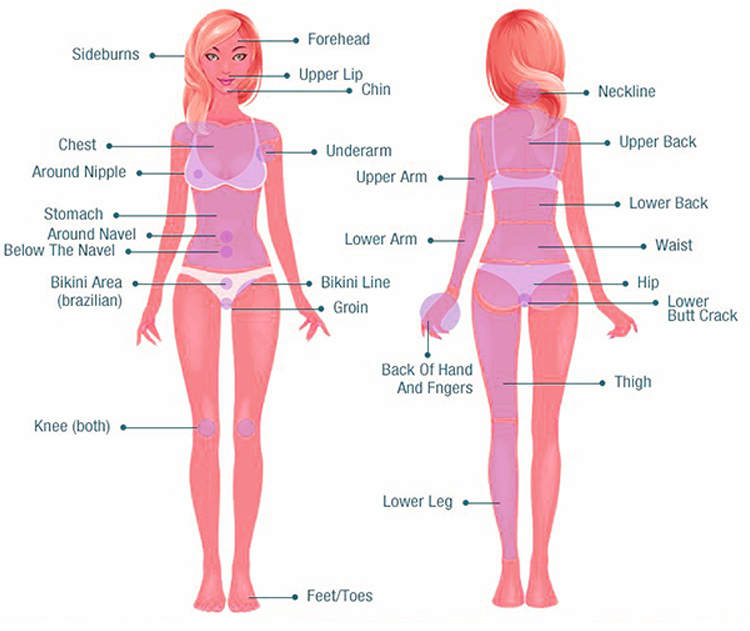 Laser Hair Removal with Diode Ice Tri-Wave requires patch test