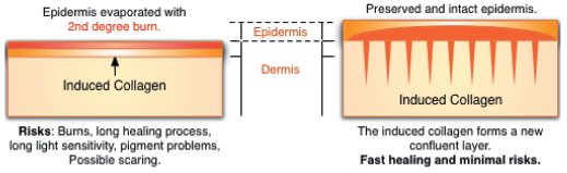 MICRONEEDLE THERAPY at Parkland Natural Health