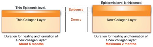 MICRONEEDLE at Parkland Natural Health