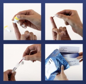 Food intolerance test of 208 ingredients at Parkland Natural Health