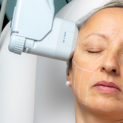 High Intensity Focused Ultrasound (HIFU) â What is it?